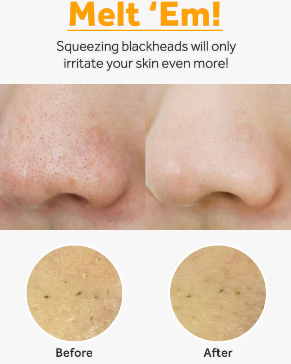 Pure Cleansing Oil - Image 7